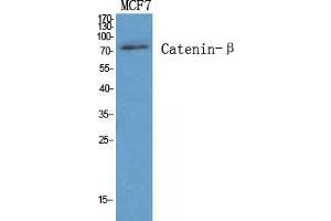 Western Blot (WB) analysis of specific cells using Catenin-beta Polyclonal Antibody. (beta Catenin 抗体  (Ser290))