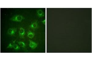 Immunofluorescence analysis of HuvEc cells, using CrkII (Ab-221) Antibody. (Crk 抗体  (AA 187-236))