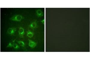 Immunofluorescence analysis of HuvEc cells, using CrkII (Ab-221) Antibody. (Crk 抗体  (AA 187-236))