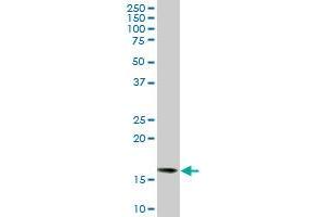 ACP1 monoclonal antibody (M06), clone 2A3. (ACP1 抗体  (AA 1-158))