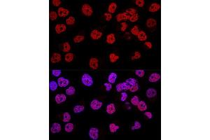 Confocal immunofluorescence analysis of Hela cells using WT1 Polyclonal Antibody (ABIN7271369) at dilution of 1:200. (WT1 抗体  (AA 1-302))