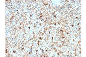 Formalin-fixed, paraffin-embedded human Cerebellum stained with GFAP Mouse Monoclonal Antibody (GFAP/2076). (GFAP 抗体  (AA 101-200))