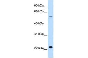 Western Blotting (WB) image for anti-Solute Carrier Family 17 (Acidic Sugar Transporter), Member 5 (SLC17A5) antibody (ABIN2462751) (Solute Carrier Family 17 (Acidic Sugar Transporter), Member 5 (SLC17A5) 抗体)
