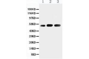 Anti-KIN antibody, Western blotting Lane 1: Rat Skeletal Muscle Tissue Lysate Lane 2: Human Placenta Tissue Lysate Lane 3: Rat Testis Tissue Lysate (KIN 抗体  (N-Term))