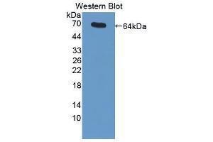 Western blot analysis of the recombinant protein. (MME 抗体  (AA 455-750))