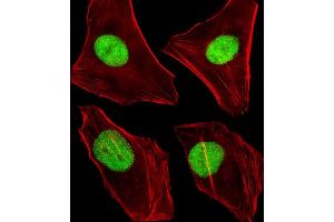 Immunofluorescent analysis of 4 % paraformaldehyde-fixed, 0. (DNMT1 抗体  (AA 881-914))