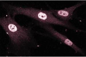 Immunofluroescence staining of Human Fibroblasts. (MEF2D 抗体  (AA 346-511))