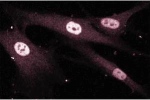 Immunofluroescence staining of Human Fibroblasts.
