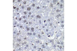 Immunohistochemistry of paraffin-embedded mouse liver using RBBP5 antibody at dilution of 1:100 (x40 lens). (RBBP5 抗体)