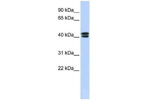 Western Blotting (WB) image for anti-Calcium Channel, Voltage-Dependent, beta 3 Subunit (CACNB3) (N-Term) antibody (ABIN633634)