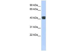 CACNB3 antibody used at 1 ug/ml to detect target protein. (CACNB3 抗体  (N-Term))