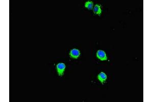Immunofluorescent analysis of Hela cells using ABIN7160774 at dilution of 1:100 and Alexa Fluor 488-congugated AffiniPure Goat Anti-Rabbit IgG(H+L) (SMYD2A 抗体  (AA 115-272))