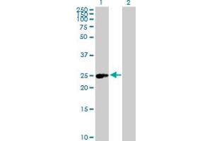 Western Blot analysis of ERAS expression in transfected 293T cell line by ERAS MaxPab polyclonal antibody. (ERAS 抗体  (AA 1-233))