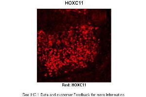 Immunohistochemistry (IHC) image for anti-Homeobox C11 (HOXC11) (Middle Region) antibody (ABIN2779771) (HOXC11 抗体  (Middle Region))