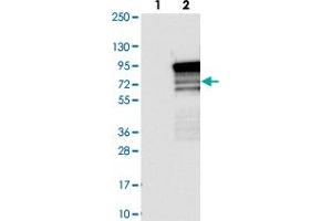 Western blot analysis of Lane 1: Negative control (vector only transfected HEK293T lysate). (TBC1D14 抗体)