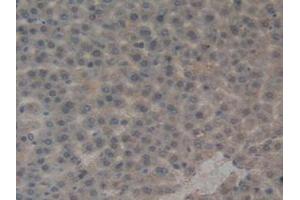 Detection of PAI1 in Rat Liver Tissue using Polyclonal Antibody to Plasminogen Activator Inhibitor 1 (PAI1) (PAI1 抗体  (AA 24-402))