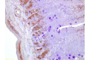 Formalin-fixed and paraffin embedded mouse small intestine labeled with Anti-NGN3/Neurogenin 3 Polyclonal Antibody, Unconjugated (ABIN729868) at 1:200 followed by conjugation to the secondary antibody and DAB staining (Neurogenin 3 抗体  (AA 61-160))