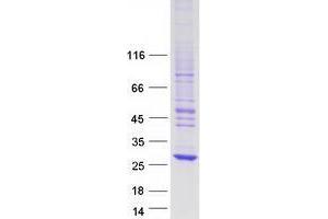 Western Blotting (WB) image for Nucleoredoxin Like Protein 1 (NXNL1) protein (Myc-DYKDDDDK Tag) (ABIN2734689)