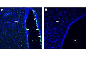 Expression CMKLR1 in rat paraventricular nucleus (PVN). (CMKLR1 抗体  (Extracellular))