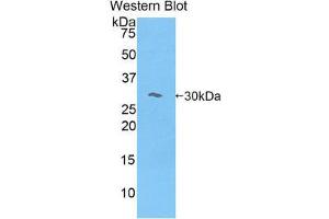 Western Blotting (WB) image for anti-Myosin IE (MYO1E) (AA 781-1036) antibody (ABIN1078393) (MYO1E 抗体  (AA 781-1036))
