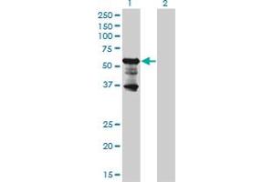 Western Blot analysis of PKNOX2 expression in transfected 293T cell line by PKNOX2 monoclonal antibody (M01), clone 4B6. (PKNOX2 抗体  (AA 116-215))