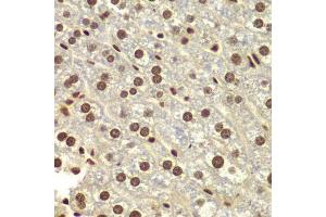 Immunohistochemistry of paraffin-embedded mouse liver using DDX5 antibody. (DDX5 抗体  (AA 1-614))