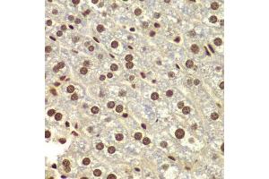 Immunohistochemistry of paraffin-embedded mouse liver using DDX5 antibody. (DDX5 抗体  (AA 1-614))