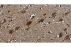 Immunohistochemistry of paraffin-embedded Human brain tissue using GLIPR1 Polyclonal Antibody at dilution 1:50 (GLIPR1 抗体)