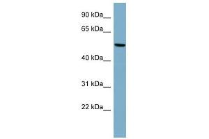 PRPH antibody used at 1 ug/ml to detect target protein. (Peripherin 抗体  (Middle Region))