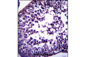 TSPYL5 Antibody (C-term) (ABIN657506 and ABIN2846530) immunohistochemistry analysis in formalin fixed and paraffin embedded human testis tissue followed by peroxidase conjugation of the secondary antibody and DAB staining. (TSPYL5 抗体  (C-Term))