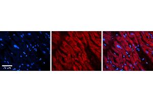 Rabbit Anti-ATG13 Antibody Catalog Number: ARP64383_P050 Formalin Fixed Paraffin Embedded Tissue: Human heart Tissue Observed Staining: Cytoplasmic Primary Antibody Concentration: 1:100 Other Working Concentrations: N/A Secondary Antibody: Donkey anti-Rabbit-Cy3 Secondary Antibody Concentration: 1:200 Magnification: 20X Exposure Time: 0. (ATG13 抗体  (N-Term))