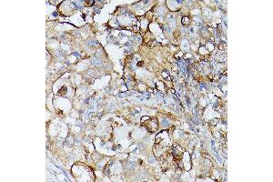 Immunohistochemistry of paraffin-embedded rat spleen using CD81 Rabbit pAb (ABIN6134776, ABIN6138231, ABIN6138232 and ABIN6220897) at dilution of 1:50 (40x lens).