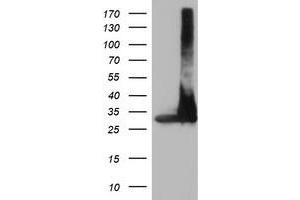 Western Blotting (WB) image for anti-Proteasome Subunit alpha 4 (PSMA4) antibody (ABIN1500458) (PSMA4 抗体)