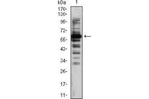 Western blot analysis using TIP60 mouse mAb against Hela (1) cell lysate. (KAT5 抗体  (AA 18-208))