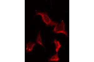 ABIN6278617 staining HuvEc by IF/ICC. (OR7C2 抗体  (Internal Region))