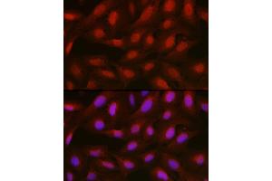 Immunofluorescence analysis of U2OS cells using [KO Validated]  Rabbit pAb (ABIN6133581 and ABIN6136917) at dilution of 1:100 (40x lens). (Annexin a1 抗体)