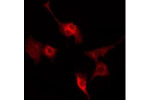 ABIN6269172 staining HeLa by IF/ICC. (SYN1 抗体  (N-Term))