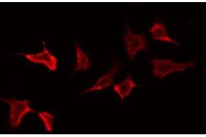 ABIN6272403 staining NIH-3T3 by IF/ICC. (PTPRN2 抗体  (Internal Region))