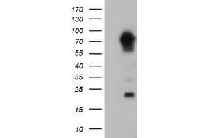 Western Blotting (WB) image for anti-Myotubularin Related Protein 14 (MTMR14) antibody (ABIN1499586) (MTMR14 抗体)