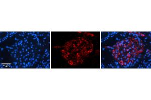 Rabbit Anti-ERGIC3 Antibody   Formalin Fixed Paraffin Embedded Tissue: Human Testis Tissue Observed Staining: Cytoplasm in Leydig cells Primary Antibody Concentration: N/A Other Working Concentrations: 1:600 Secondary Antibody: Donkey anti-Rabbit-Cy3 Secondary Antibody Concentration: 1:200 Magnification: 20X Exposure Time: 0. (ERGIC3 抗体  (C-Term))