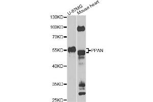 Western blot analysis of extracts of various cell lines, using PPAN Antibody (ABIN5975126) at 1/1000 dilution. (PPAN 抗体)