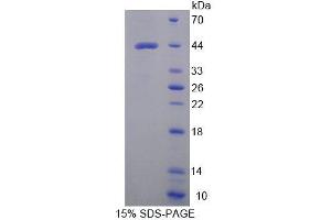 SDS-PAGE analysis of Mouse WARS2 Protein. (WARS2 蛋白)