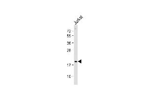 Anti-p19 Antibody (N-term) at 1:2000 dilution + Jurkat whole cell lysate Lysates/proteins at 20 μg per lane. (CDKN2D 抗体  (N-Term))