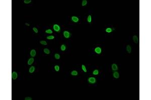 Immunofluorescent analysis of Hela cells using ABIN7139589 at dilution of 1:100 and Alexa Fluor 488-congugated AffiniPure Goat Anti-Rabbit IgG(H+L) (HIST1H1C 抗体  (meLys118))