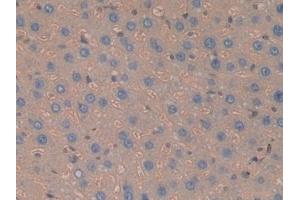 Detection of Hpt in Rat Liver Tissue using Polyclonal Antibody to Haptoglobin (Hpt) (Haptoglobin 抗体  (AA 70-332))