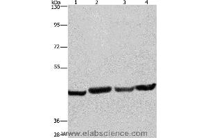 Western blot analysis of A549, Hela, PC3 and HepG2 cell, using RBMY1A1 Polyclonal Antibody at dilution of 1:360 (RBMY1A1 抗体)