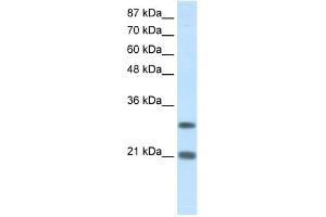 WB Suggested Anti-MSX2 Antibody Titration:  1. (Msx2/Hox8 抗体  (N-Term))