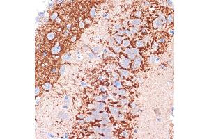 Immunohistochemistry (IHC) image for anti-Cadherin 13 (CDH13) antibody (ABIN7265996)