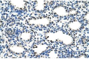 Human Lung; ARIH2 antibody - N-terminal region in Human Lung cells using Immunohistochemistry (ARIH2 抗体  (N-Term))