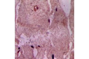 Immunohistochemical analysis of ACOT9 staining in human heart formalin fixed paraffin embedded tissue section. (ACOT9 抗体  (Center))